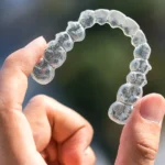 Nakładki Invisalign w Warszawie